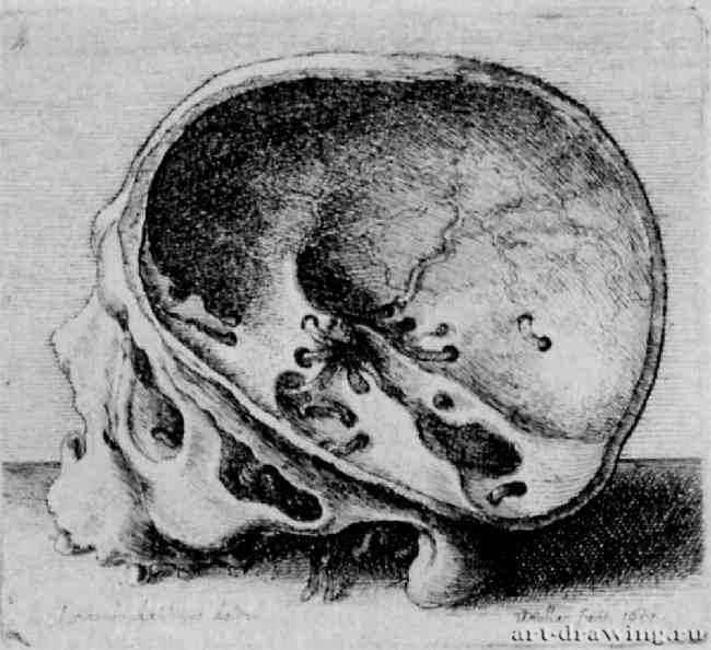 Распиленный человеческий череп. 1651 - 70 х 76 мм. Офорт. Берлин. Гравюрный кабинет. Чехия.